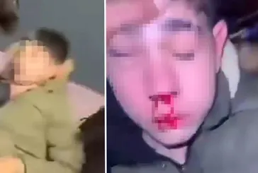 Sağır ve dilsiz çocuğa işkence! Kulağını kesmeye çalıştılar