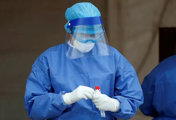 Bilim insanları ilk kez açıkladı! Koronavirüs hastalarını öldüren sinsi enfeksiyon!-3