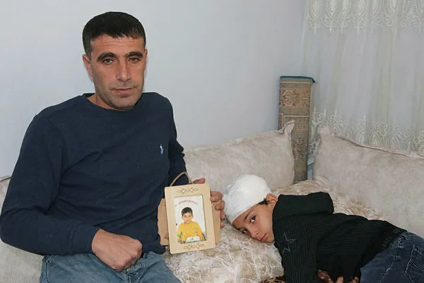 Diyarbakır'da 7 yaşındaki çocuğa sokak köpeği saldırdı! Başına 30 dikiş atıldı-2