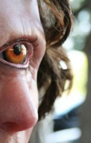 Rüyada tek göz görmek ne anlama gelir?