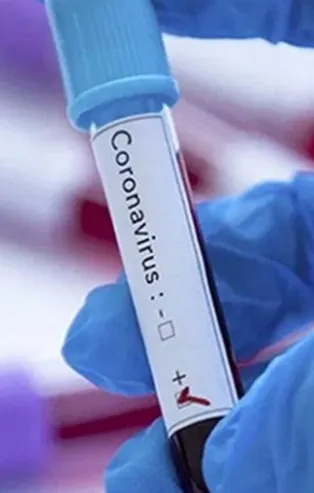 Brezilya Ligi'nde koronavirüs şoku | Vasco da Gama'da 16 oyuncunun testi pozitif çıktı