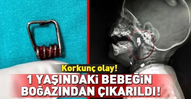 Nevşehir’de korkunç olay! 1 yaşındaki bebeğin boğazından çıkarıldı