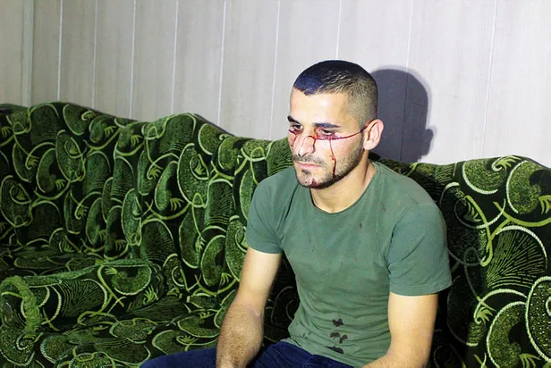 23 yaşındaki Iraklı genç iki aydır kan ağlıyor-3