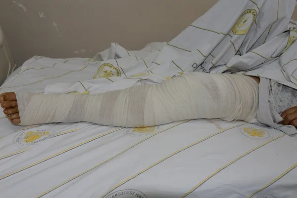 diyarbakirda-72-yasindaki-kadin-korona-nedeniyle-15-yil-hastaneye-gitmedi-uylugundaki-5-kiloya-ulasan-tumor-ameliyatla-alindi-1624006133185.jpg Diyarbakır'da 72 yaşındaki kadın korona nedeniyle 1,5 yıl hastaneye gitmedi! Uyluğundaki 5 kiloya ulaşan tümör ameliyatla alındı-11