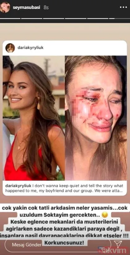 Şeyma Subaşı’nın Ukraynalı model arkadaşı Daria Kyryliuk Çeşme’de darp edildi! Olayla ilgili yeni gelişme...
