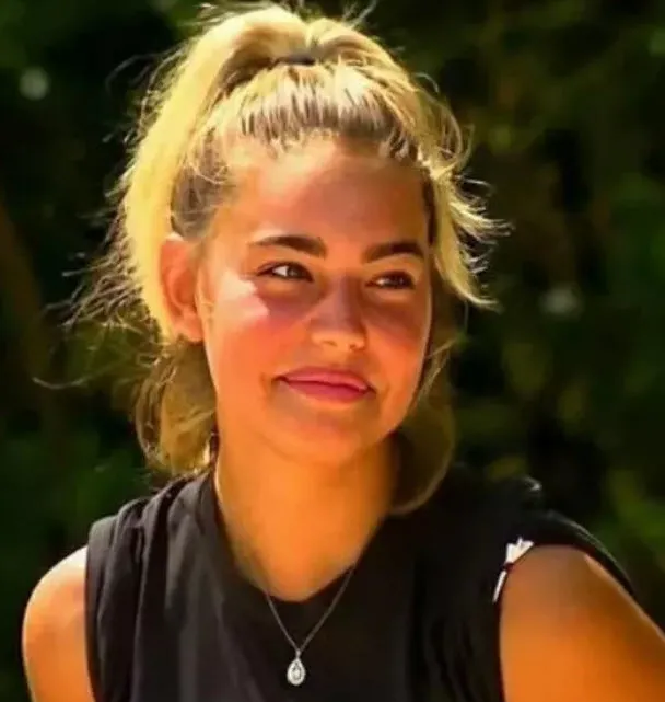 Survivor Aycan'ın son halini görenlerin küçük dili içeri kaçtı 'yazık ettin kendine!' Yarışmayı bırakıp giden Aycan Yanaç aylar sonra...-3