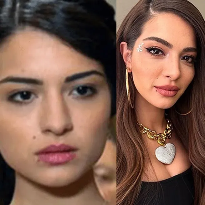 Yüz lifting yaptıran Ebru Yaşar’ın son hali olay oldu: İnsan bunu kendine nasıl yapar? - 19