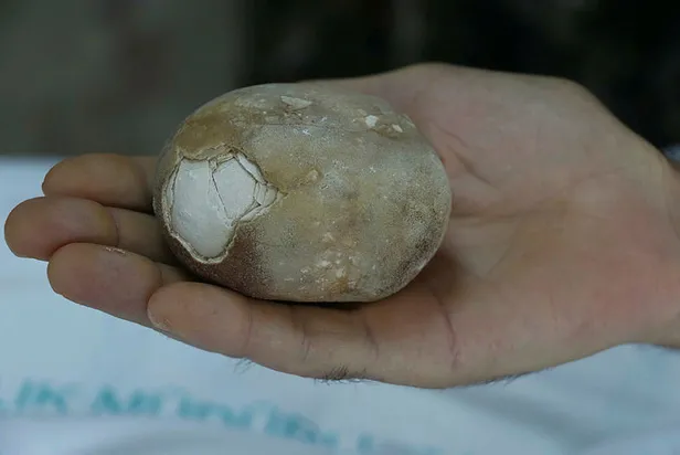 Samsun'da doktorları şoke eden olay: Görünce patates sandım-3
