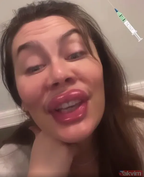 5 ay önce anne olan Demet Evgar’ın paylaşımını gören tanımakta zorlandı! Botoks ve dolguyu fazla kaçıranları fena ti’ye aldı... - 6