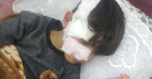 Gaziantep'te başıboş köpek dehşeti: 8 yaşındaki Yusuf ağır yaralandı