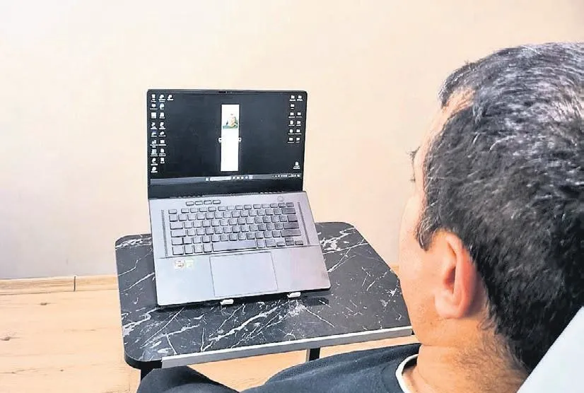 Kas hastaları için yapay zeka destekli çözüm