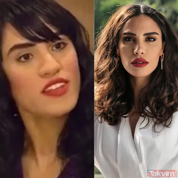 Yeşilçam’ın Sultan’ı Türkan Şoray'ın kızı Yağmur Ünal’ın son haline bakın! Botokstan konuşamadı! Gören şaştı kaldı - 15