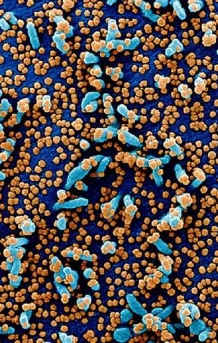 Koronavirüsün insan hücrelerindeki yayılışı mikroskopla görüntülendi