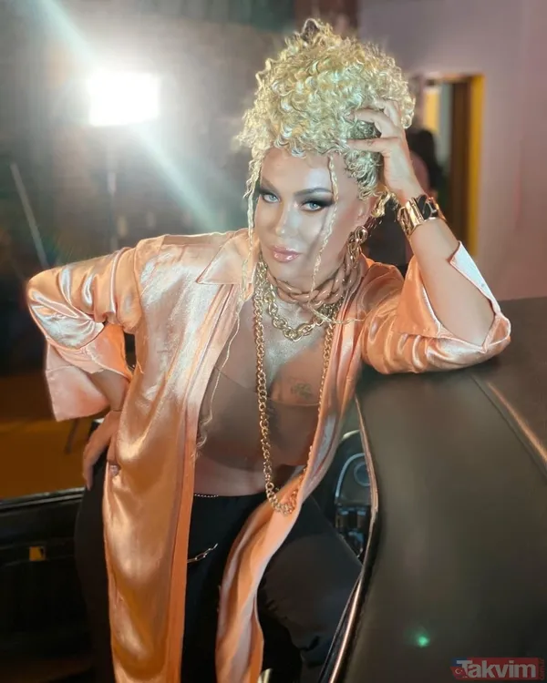 Murat Kurşun’dan estetik itirafı! Son hali dikkat çekti! Rafet El Roman ve Gökhan Özen’in ardından... - 28