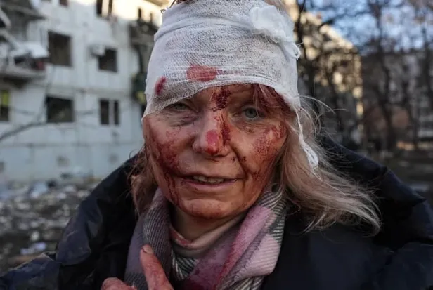 rusya-ukrayna-savasi-kac-kisi-oldu-kac-kisi-yaralandi-rusya-ukraynanin-hangi-sehirlerine-saldirdi-iste-son-dak-1645689228349.jpg Rusya Ukrayna'nın hangi şehirlerine saldırdı? Rusya Ukrayna savaşı kaç kişi öldü, kaç kişi yaralandı? İşte son dakika görüntüler...-1