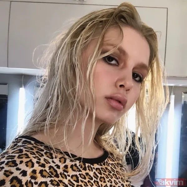 Aleyna Tilki’nin şiş dudakları olay oldu! Son halini gören dönüp bir daha baktı “Ajda Pekkan olma yolunda” - 3