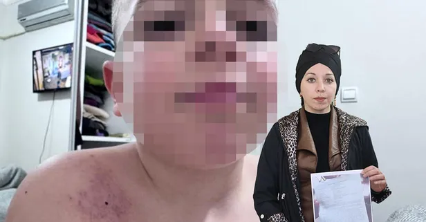 Antalya'da öğrenciye şiddet iddiası: Anne şikayetçi oldu | Karanlık oda tehdidi