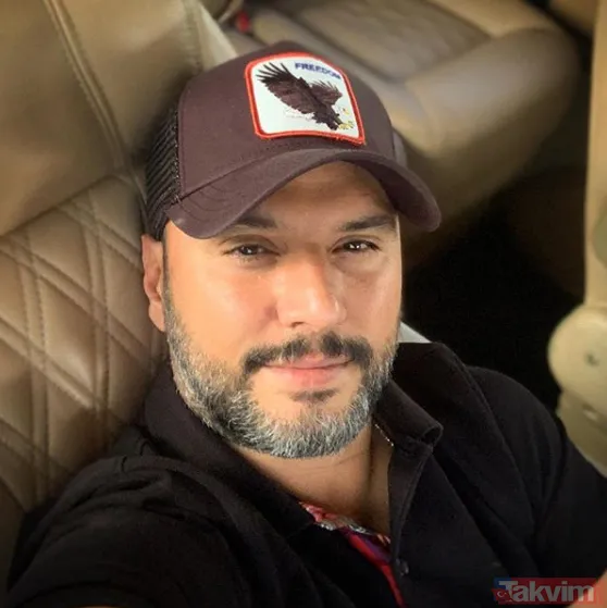 Alişan'ın eşi Buse Varol'un bu halini görenler şoke oldu 'buruşarak yaşlanmak istiyorum' demişti! Estetik güzeli... - 20