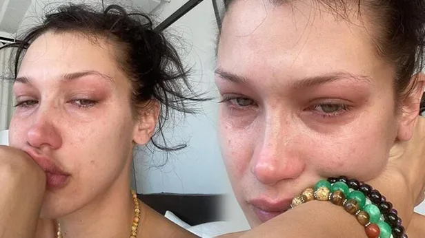 Bella Hadid'in durumu hiç iyi değil yana yakıla ağladı ve paylaştı 'her gece ağlıyorum vazgeçemiyorum' nesi var bu kızın?-2