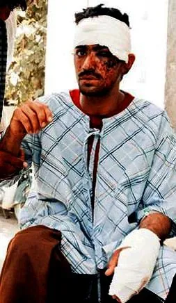 Düğün törenine intihar saldırısı