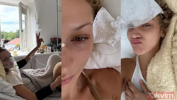 Lyme Hastalığı Nedir? Lyme Hastalığı, Borrelia Burgdorferi Adlı Bakterinin Neden Olduğu Bir Enfeksiyondur Ve Genellikle Enfekte Kenelerin Isırması Yoluyla...