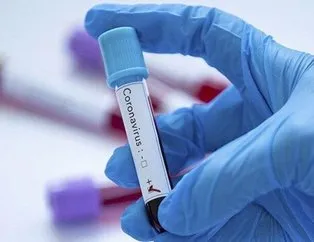 Çad’da ilk koronavirüs vakası görüldü