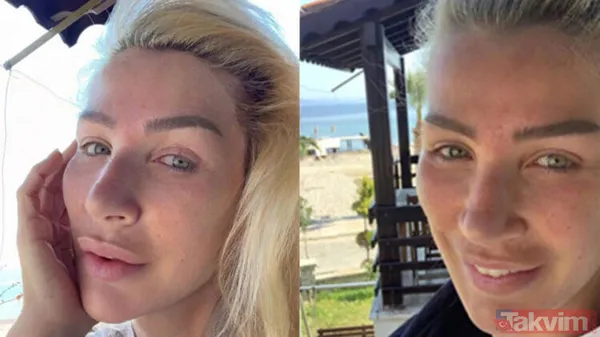 Seda Sayan'dan botoks itirafı: Botokslar, dolgular gitti bacım! Bu halleri olay yarattı - 4