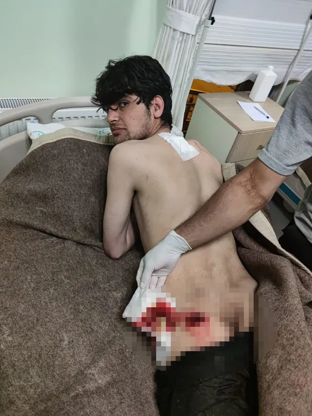 yunan-polisi-gocmenleri-plastik-mermilerle-yaraladi-1653548583973.jpg Yunan polisi göçmenleri plastik mermilerle yaraladı!-2