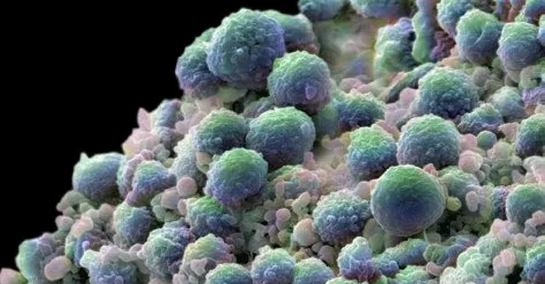 Prostat kanserine dikkat