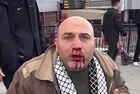Filistin'e destek yürüyüşünden dönen vatandaşı "sen Arap sevicisin" diyerek yumrukladı! Provokatör tutuklandı