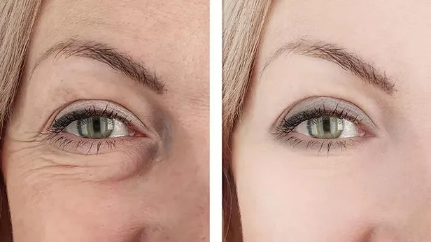 tek-damlasiyla-kirisikliklara-veda-edin-ince-cizgileri-doldurarak-genclestiriyor-iste-mucize-etki-yaratan-doga-1655286557198.jpeg İnce çizgileri doldurarak gençleştiriyor! Tek damlasıyla kırışıklıklara veda edin! İşte mucize etki yaratan doğal formül!-5