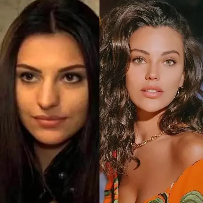 Yasemin Özilhan estetik açıklamasıyla sosyal medyanın diline düştü: Yeme bizi Yasemin! - 16