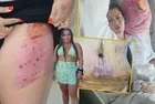 Estetik faciası! Fazla yağlarını aldırmak istedi hayatının şokunu yaşadı! 4 ayda 9 ameliyat