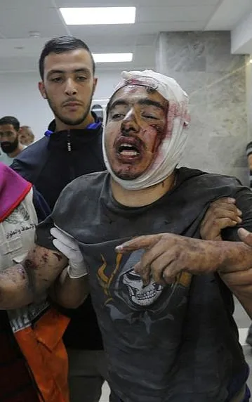 1699908737055.jpeg Terör devleti İsrail Gazze'de bir nefeslik oksijen bile bırakmadı! Filistinli Cevdet Medhun: "Şifa'da yaşamak ölmekten zor"-4