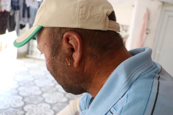 yangini-sondurmeye-calisirken-traktoruyle-birlikte-alevlerin-icinde-kalan-ciftci-kolumdaki-deri-naylon-gibi-acildi-yine-olsa-hic-dusunmeden-giderim-1627997340990.jpg Yangını söndürmeye çalışırken traktörüyle birlikte alevlerin içinde kalan çiftçi: Kolumdaki deri naylon gibi açıldı! Yine olsa hiç düşünmeden giderim-12