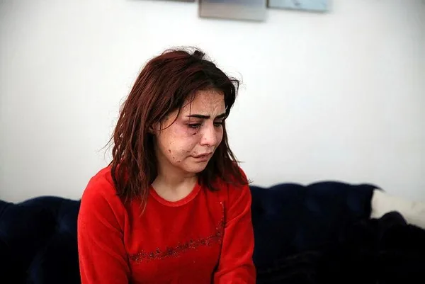 Son dakika: Antalya Alanya'da yürek yakan 'ölmek istemiyorum' çığlığı! Beyza Yurttaş öldüresiye dövüldü-2