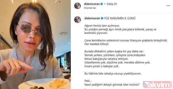 Eski Survivor yarışmacısı Didem Ceran Güney Kore'de 15 saatlik "yüz nakli" operasyonu geçirdi - 4