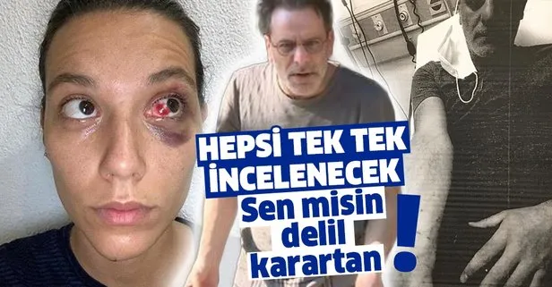 Ozan Güven'in genç sevgilisi Deniz Bulutsuz'u darp ettiği olayda gelişme | Tek tek incelenecek-1