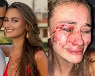 Daria Kyryliuk’un darp iddiasında sürpriz tanık