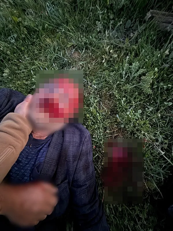 ankarada-kopekler-yuzunden-baslayan-kavgadan-aci-haber-komsularinin-dovdugu-tansel-gokmen-hayatini-kaybetti-1778052858507.jpeg Ankara'da "köpekler" yüzünden başlayan kavgadan acı haber: Komşularının dövdüğü Tansel Gökmen hayatını kaybetti-3