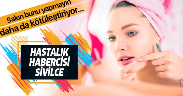 Sivilce Hastaligin Habercisi Sivilce Neden Olusur Nasil Gecer Takvim