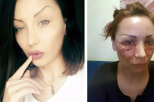 Estetik faciası! Bulgar model hayatının şokunu yaşadı! Bakın kendilerini nasıl savundu