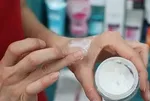 Yaz bitti, cilt lekeleri ortaya çıktı! Dermatologlar uyardı: Tedavi için en doğru zaman