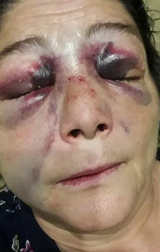 Sabah gazetesi yazarı Mevlüt Tezel'den Giresun Eynesil'deki CHP'li başkan skandalına sert tepki: CHP'liler dövünce kadına şiddet olmuyor mu?