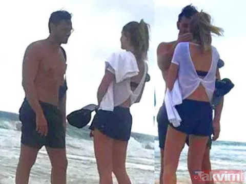 Acun Ilıcalı'nın yüzü gözü morluk içinde gören darp edildi sanıyor ama işin aslı başka! Estetik mi derken... - 32