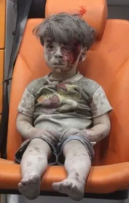 Ümran'ın doktoru konuştu