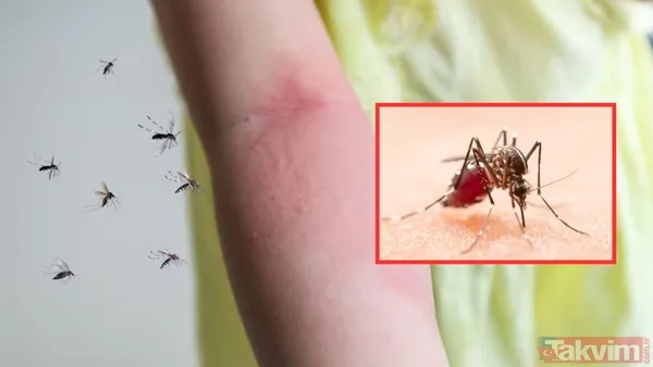Yaz Mevsiminin Gelmesiyle Birlikte Sinek Ve Böcek Isırıkları Da Artış Gösterdi. Ünlü Kozmolog Dr. Monica Kapoor, Sivrisinekleri Uzak Tutmak İçin Etkili Ve...