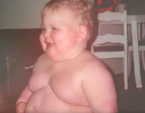 15 yaşındayken 320 kiloydu! Ameliyat olduktan sonra bambaşka biri oldu-1