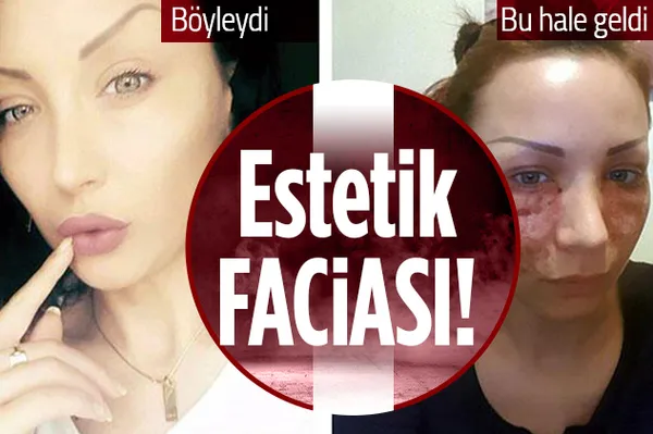 Estetik faciası! Bulgar model hayatının şokunu yaşadı! Bakın kendilerini nasıl savundu-1