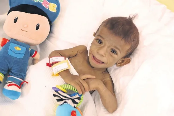 Suriyeli 16 aylık bebek, yaşam mücadelesiyle destan yazdı: Türk hekimlerinin başarılı operasyonuyla sağlığına kavuştu-1